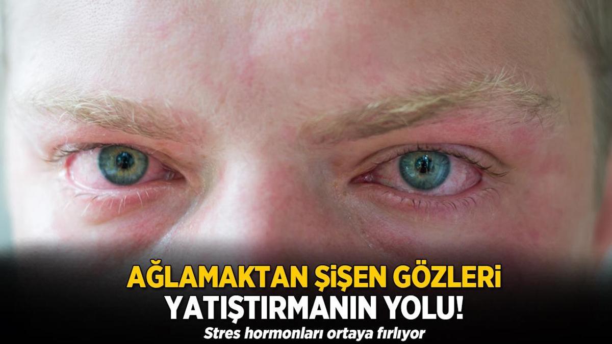 Ağlamaktan şişen gözler anında sönecek! İyi hissettiren kafein devrede